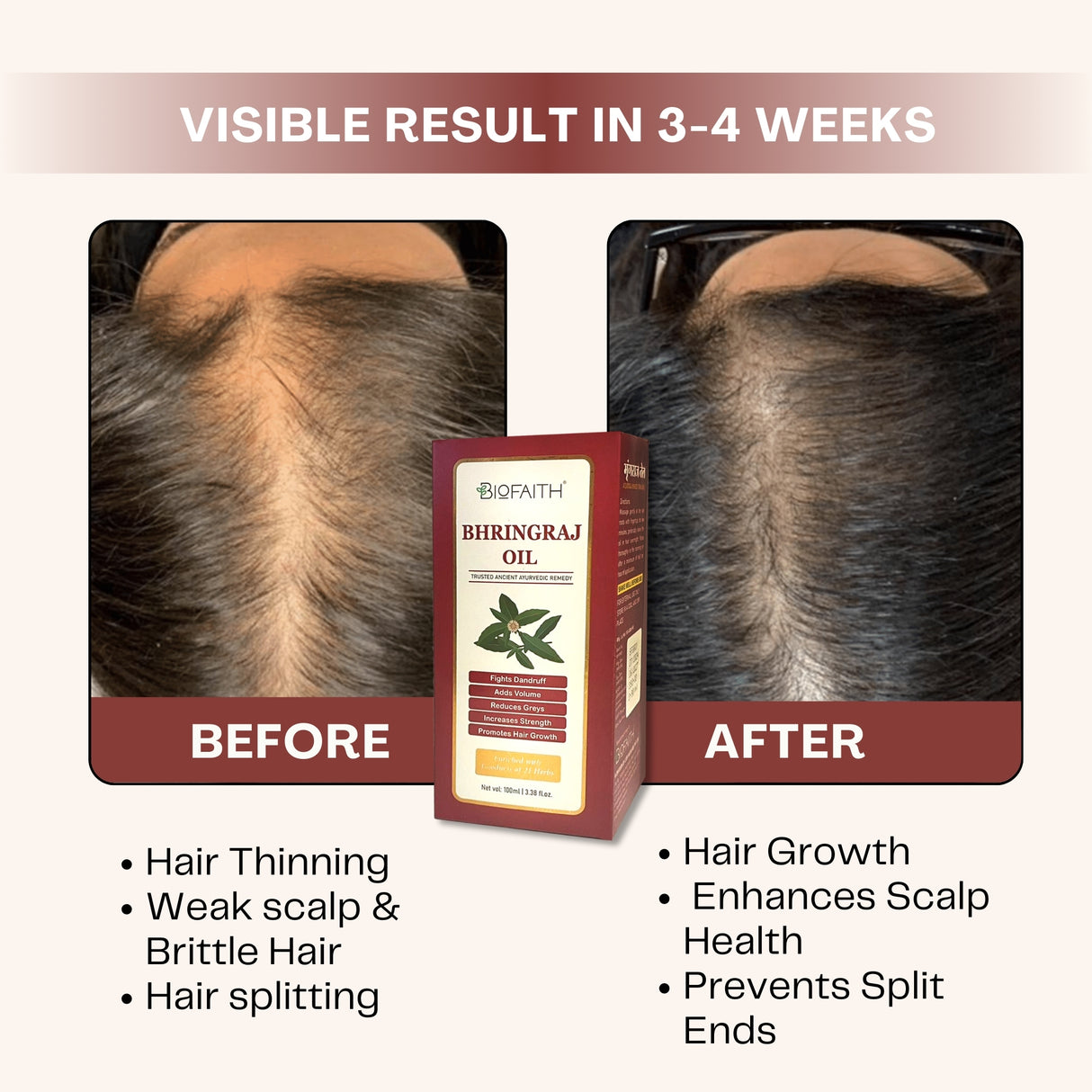 Scalp Health & Shine