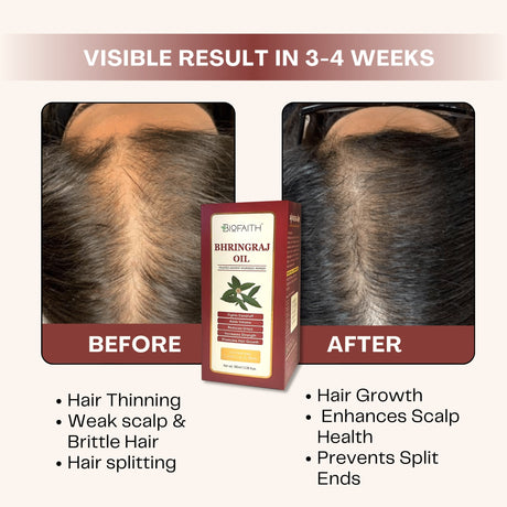Scalp Health & Shine