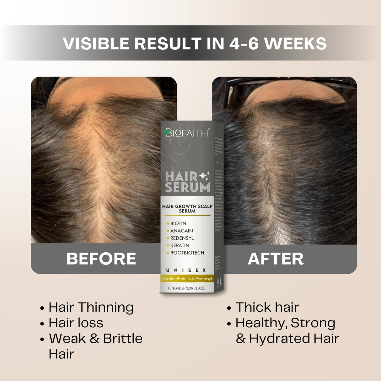 Reduces Hair Thinning