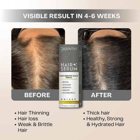 Reduces Hair Thinning