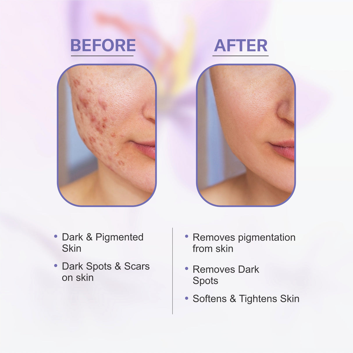 Kumkumadi Face Serum For Fairer & Radiant Skin | Reduces Dark Spots & Pigmentation - 30ml