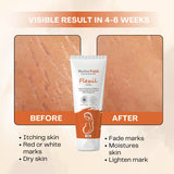 Flexil Cream | Helps to prevent & reduce stretch marks during and after pregnancy  | 100 g